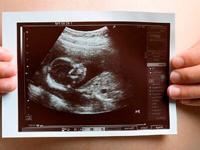 ¿Es importante realizarse ecografías al estar embarazada?