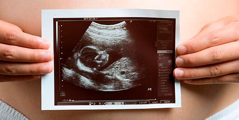¿Es importante realizarse una ecografía al estar embarazada?