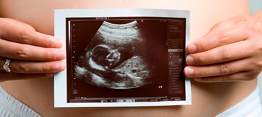 ¿Es importante realizarse una ecografía al estar embarazada?
