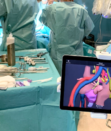 La tecnología 3D reduce las complicaciones en cirugías de cáncer de colon