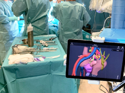 La tecnología 3D mejora los resultados de la cirugía en la enfermedad de Crohn, según un estudio