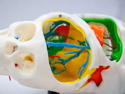 Tecnología 3D española de Cella ayuda a separar con éxito a dos gemelas egipcias