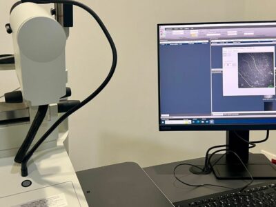 Ocumed, la única clínica privada en Madrid en ofrecer la tecnología del microscopio confocal para diagnósticos corneales