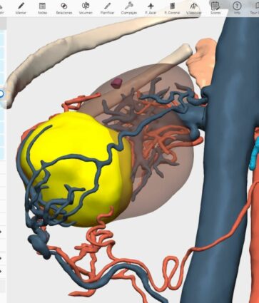 La integración de la IA en modelos 3D permitirá detectar anomalías congénitas en niños, según expertos del Congreso de la SECP