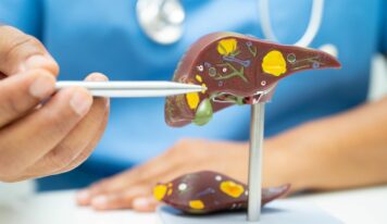 Dr. Alfredo Yoldi, endocrinólogo de Policlínica Gipuzkoa: Una nueva esperanza para el tratamiento del hígado graso