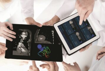 Un software con IA permite reducir en más del 60% el número de cateterismos diagnósticos innecesarios
