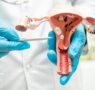 Dra. Blanca Fernández, ginecóloga de Policlínica Gipuzkoa: «Con una buena prevención y tratamiento del VPH, podemos prevenir el cáncer de cuello de útero»