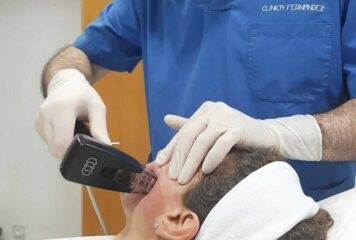 Clínica Fernández incorpora el tratamiento Morpheus8: tecnología mínimamente invasiva para rejuvenecimiento facial y corporal