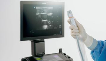 Sonosite LX introduce la ultra-alta frecuencia en POCUS con el primer y único transductor de 46 MHz