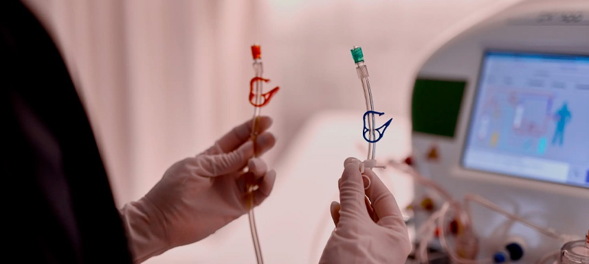 Comparación con otras técnicas de aféresis médica Comparación con otras técnicas de aféresis médica