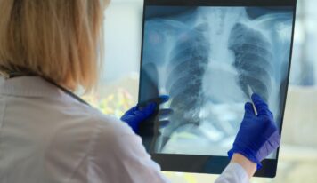 Dr. Aitor Asensi, neumológo de Policlínica Gipuzkoa: «Dejar de fumar es la medida más importante para frenar la evolución de la EPOC»