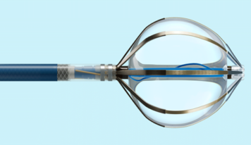 El sistema de ablación por campo pulsado de Abbott, disponible en España para tratar las arritmias cardíacas