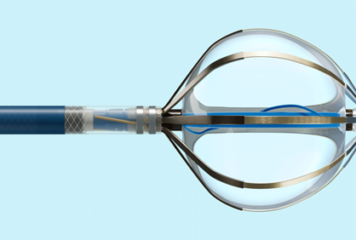 El sistema de ablación por campo pulsado de Abbott, disponible en España para tratar las arritmias cardíacas