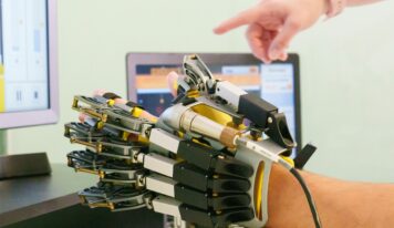 «La neurorrehabilitación permite, en momentos concretos de la enfermedad del Parkinson, mejorar limitaciones motoras, de coordinación o dolor, lo que se traduce en meses o años de vida con mayor calidad», Dr. Alejandro Durán