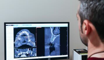 IOCantábrico analiza el papel de los implantes dentales en Gijón como solución avanzada para recuperar la sonrisa