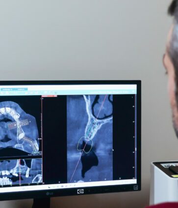 IOCantábrico analiza el papel de los implantes dentales en Gijón como solución avanzada para recuperar la sonrisa