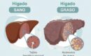 Dr. Juan Arenas, jefe servicio Aparato Digestivo:»Hoy disponemos de un nuevo medio no invasivo para detectar la fibrosis hepática»