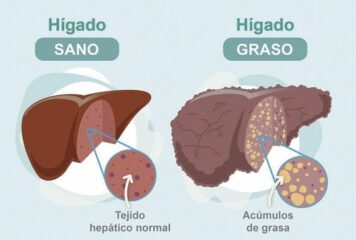 Dr. Juan Arenas, jefe servicio Aparato Digestivo:»Hoy disponemos de un nuevo medio no invasivo para detectar la fibrosis hepática»