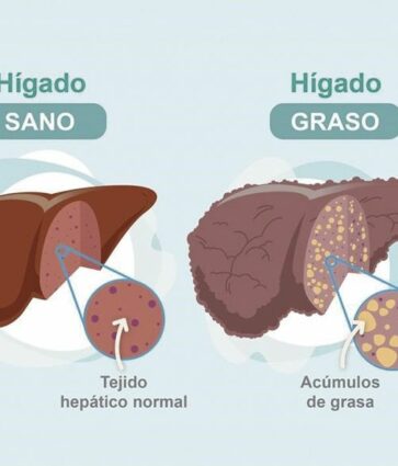 Dr. Juan Arenas, jefe servicio Aparato Digestivo:»Hoy disponemos de un nuevo medio no invasivo para detectar la fibrosis hepática»