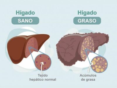 Dr. Juan Arenas, jefe servicio Aparato Digestivo:»Hoy disponemos de un nuevo medio no invasivo para detectar la fibrosis hepática»