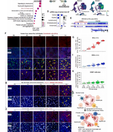 Un estudio publicado en Cell identifica ROCK2 como nueva diana terapéutica para la fibrosis hepática con el apoyo de Cloud-Clone