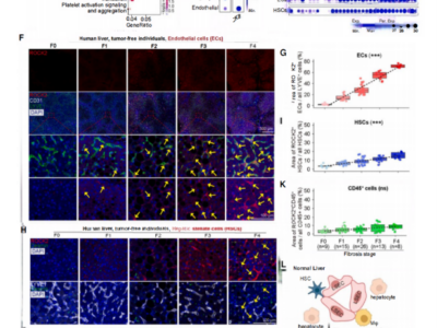 Un estudio publicado en Cell identifica ROCK2 como nueva diana terapéutica para la fibrosis hepática con el apoyo de Cloud-Clone