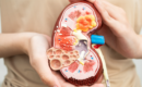 Cerca del 8% de las personas participantes en el programa de cribado de enfermedad renal en farmacias de Gipuzkoa han sido derivadas a Atención Primaria