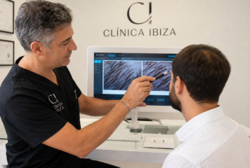 ¿Por qué se cae el pelo en agosto? Clínica Ibiza revela mitos y verdades sobre la alopecia y el calor