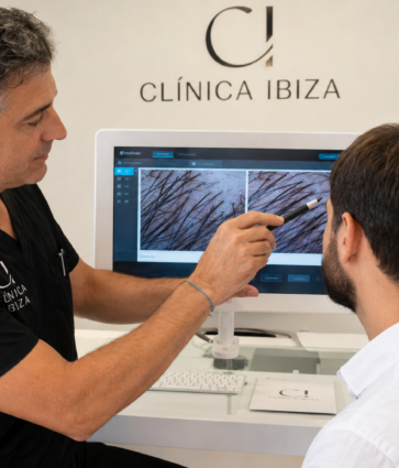 ¿Por qué se cae el pelo en agosto? Clínica Ibiza revela mitos y verdades sobre la alopecia y el calor